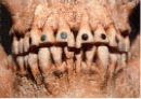 マヤ人の上の前歯